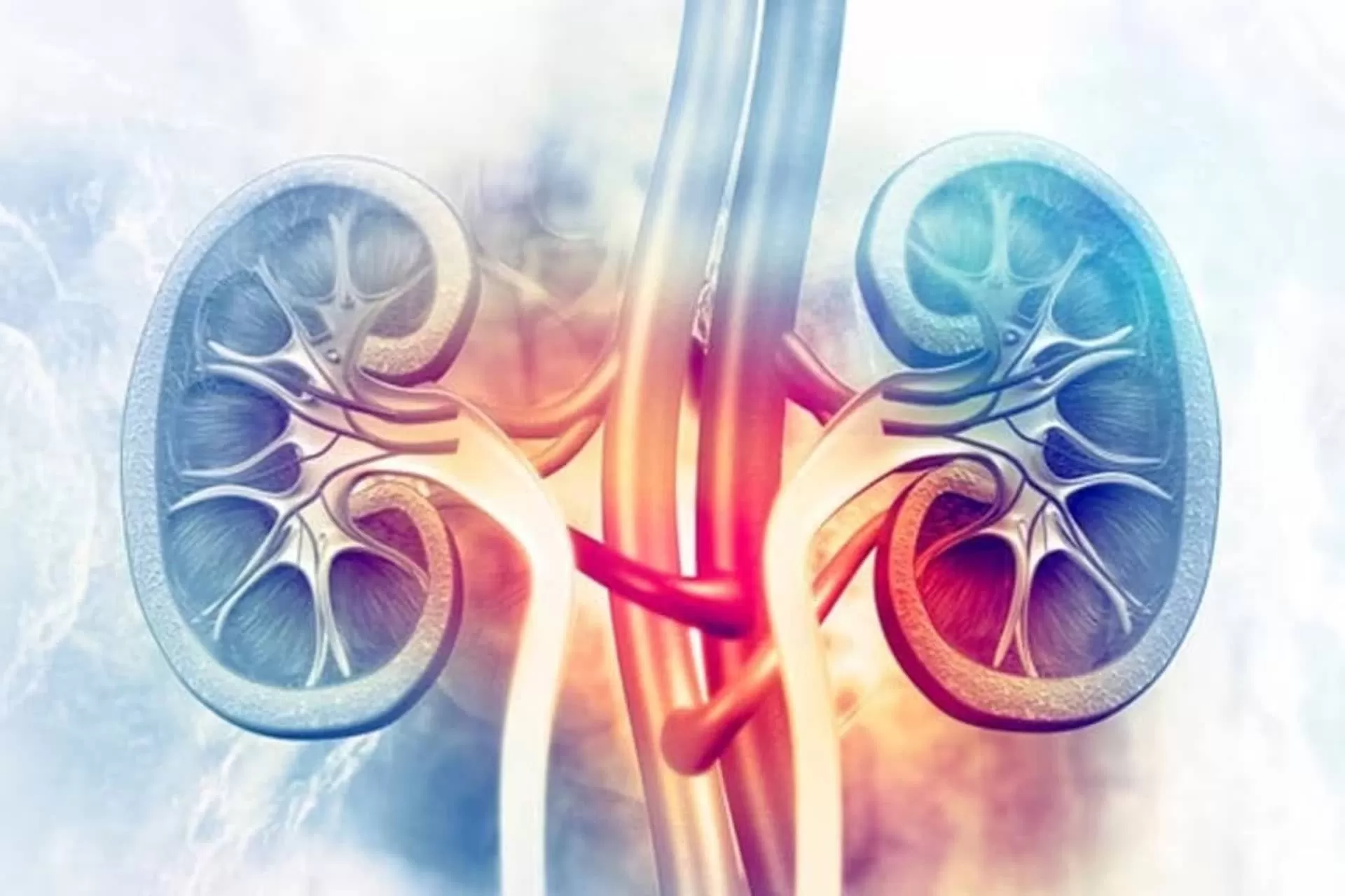 Acute kidney failure image